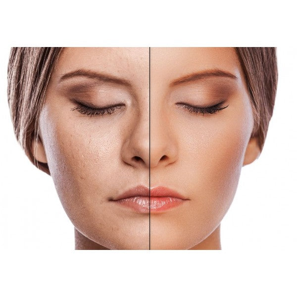 Rigenera Crema Viso AntiAge con Acido Ialuronico, Collagene, Oro Colloidale, Burro Karitè